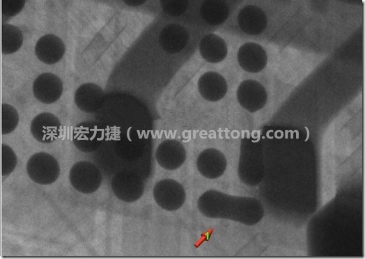 BGA因為焊墊變小，造成錫膏過多而最終形成焊接短路的結果。